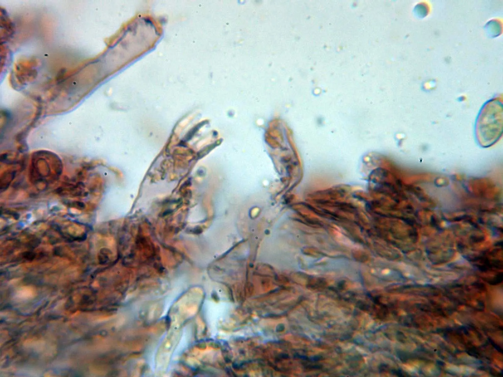 10 - Basidio tetrasporico